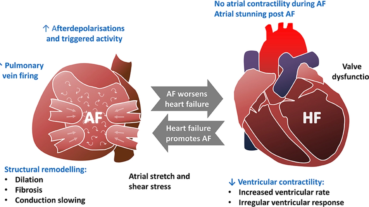 Heart Failure and Kidney Disease: A Complicated Relationship
